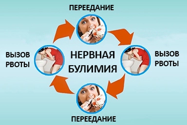 Лечение булимии в Костроме
